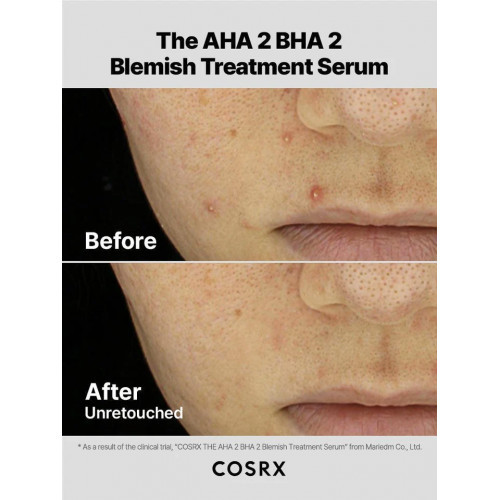 COSRX The AHA 2 BHA 2 Blemish Treatment Serum 50g