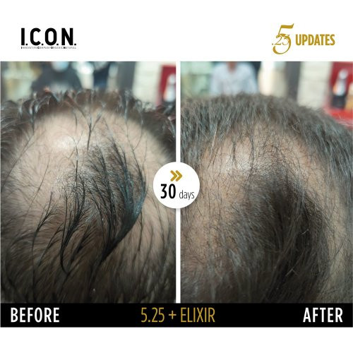 I.C.O.N. 5.25 Hair Growth Replenisher 100ml