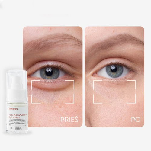 Skinlovers 4’E Anti-Puff & Wrinkle Eye Cream 15ml