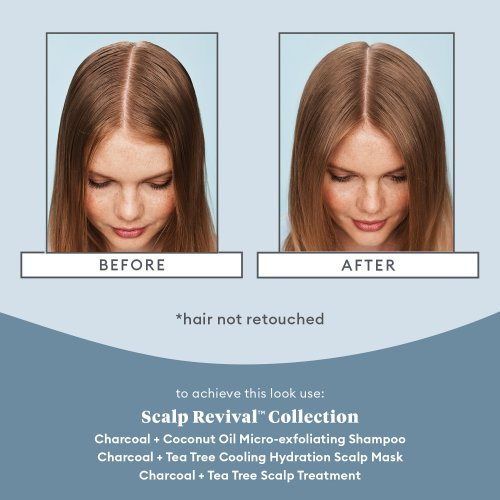 Briogeo Scalp Revival Scalp Soothing Solutions Set