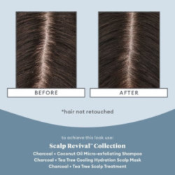 Briogeo Scalp Revival Scalp Soothing Solutions Set